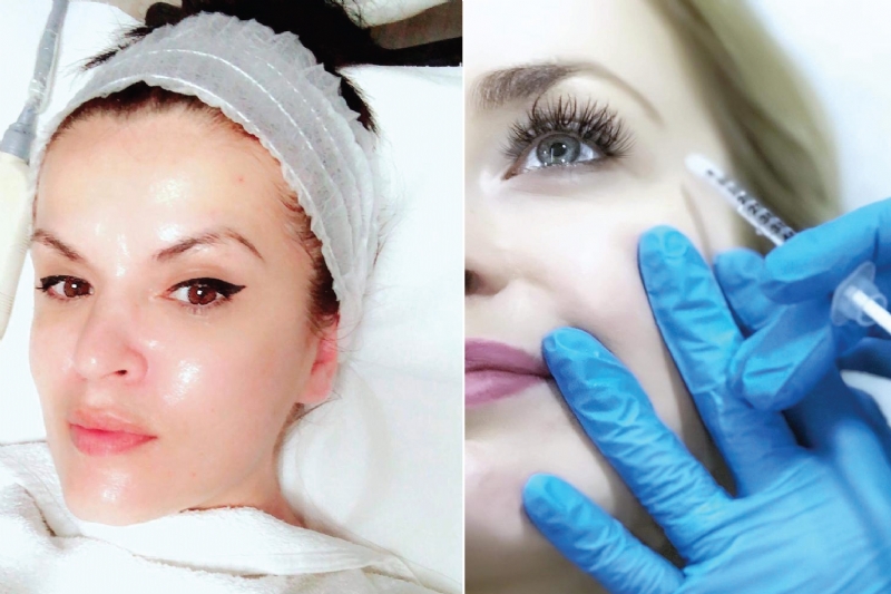 Vizita Dermatologjike, Trajtime estetike per fytyren, spa ditore, Filler...