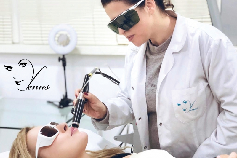Kirurgji Dermatologjike me laser, heqjen e kapilarëve me lazer në fytyrë...
